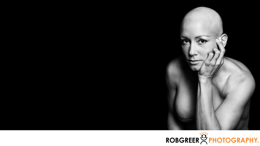 Powerful Survivor Photograph of Double Mastectomy