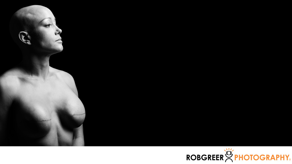 Photo of Strong Female Double Mastectomy Patient